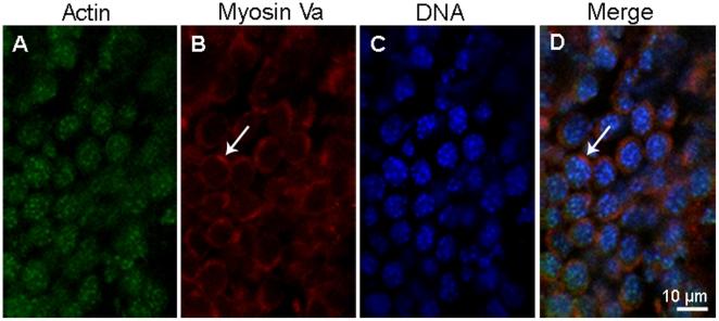 https://cdn.ncbi.nlm.nih.gov/pmc/blobs/6546/2939076/1acf6f9577db/pone.0012738.g003.jpg