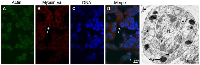 https://cdn.ncbi.nlm.nih.gov/pmc/blobs/6546/2939076/40cb0fbbc7d2/pone.0012738.g004.jpg
