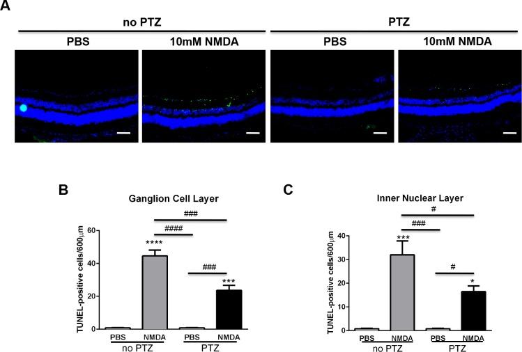 https://cdn.ncbi.nlm.nih.gov/pmc/blobs/6548/4758298/03d542ac00ea/i1552-5783-57-2-453-f03.jpg
