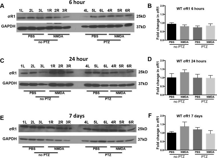 https://cdn.ncbi.nlm.nih.gov/pmc/blobs/6548/4758298/f2a8f65c2a4e/i1552-5783-57-2-453-f05.jpg