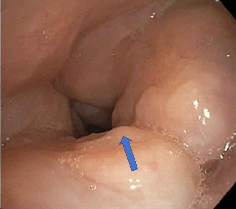 https://cdn.ncbi.nlm.nih.gov/pmc/blobs/6554/7594666/054812d627d0/cureus-0012-00000010713-i04.jpg