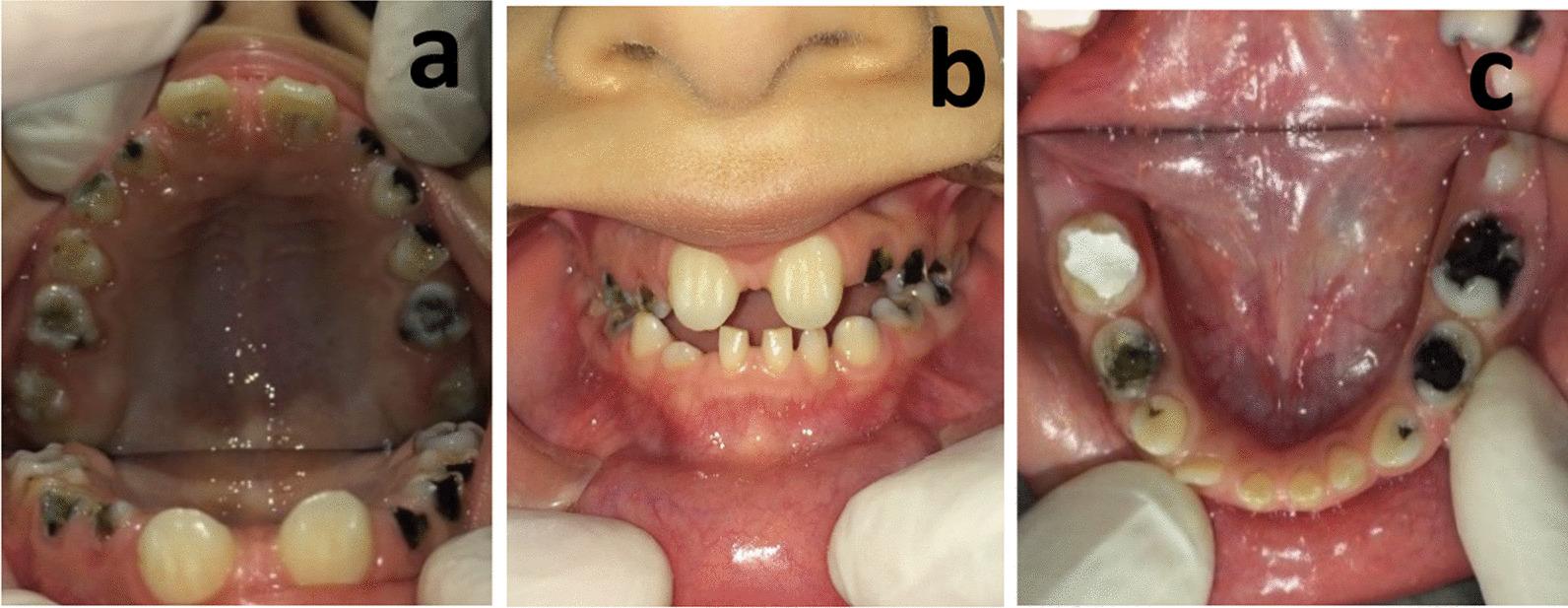 https://cdn.ncbi.nlm.nih.gov/pmc/blobs/6557/9827620/7ec3927834fb/12903_2022_2593_Fig1_HTML.jpg