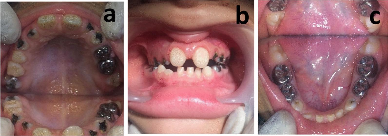 https://cdn.ncbi.nlm.nih.gov/pmc/blobs/6557/9827620/c7a17c640362/12903_2022_2593_Fig4_HTML.jpg