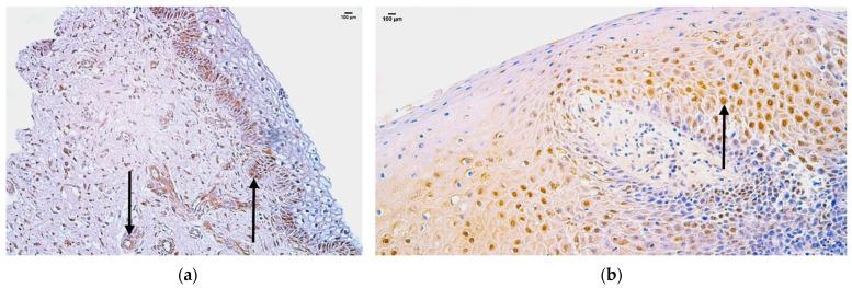 https://cdn.ncbi.nlm.nih.gov/pmc/blobs/6558/11433168/1a83ec2a9588/jpm-14-00965-g003.jpg