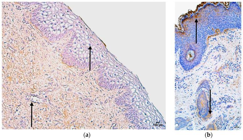 https://cdn.ncbi.nlm.nih.gov/pmc/blobs/6558/11433168/e7653205e7c9/jpm-14-00965-g007.jpg