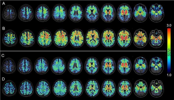 https://cdn.ncbi.nlm.nih.gov/pmc/blobs/6560/12056779/21132ccf5553/gr3.jpg