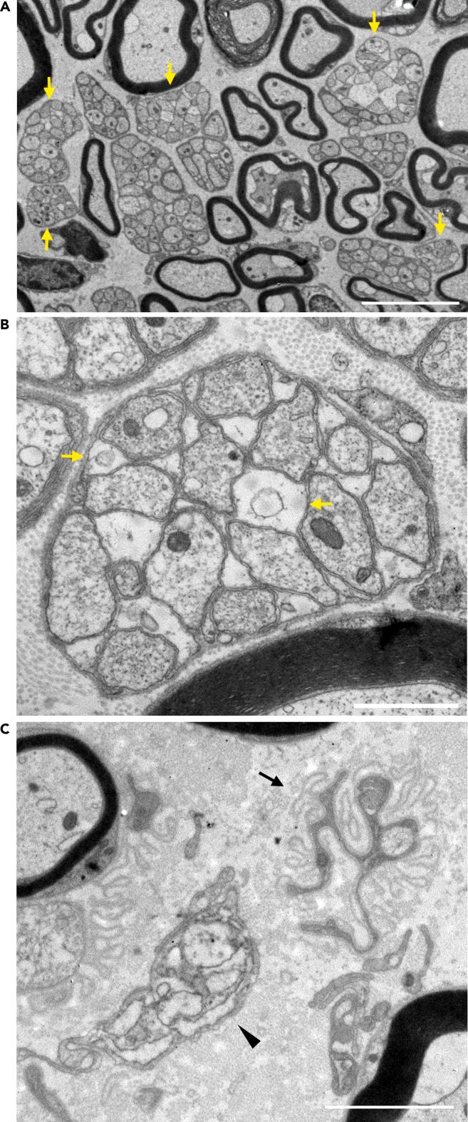 https://cdn.ncbi.nlm.nih.gov/pmc/blobs/6566/8719014/f092316dcb63/gr6.jpg