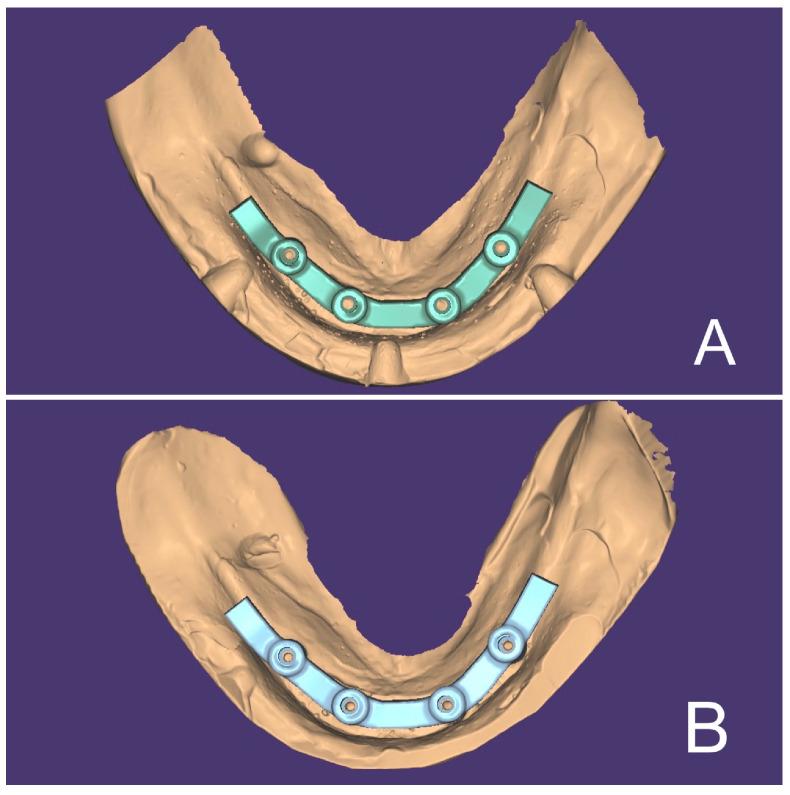 https://cdn.ncbi.nlm.nih.gov/pmc/blobs/6568/10254348/70be8f9bb193/materials-16-04176-g004.jpg