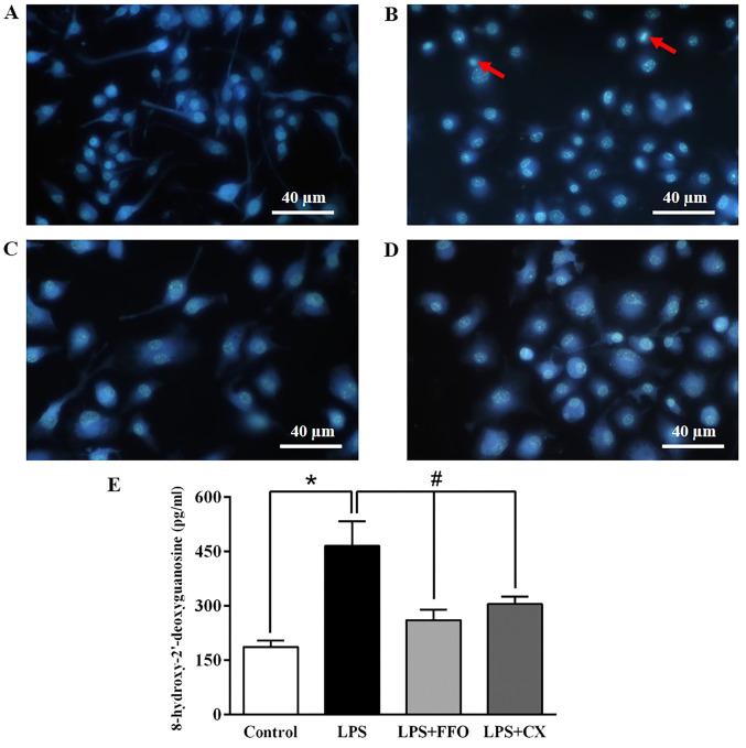https://cdn.ncbi.nlm.nih.gov/pmc/blobs/6571/8453337/7f693ae78772/etm-22-05-10657-g03.jpg