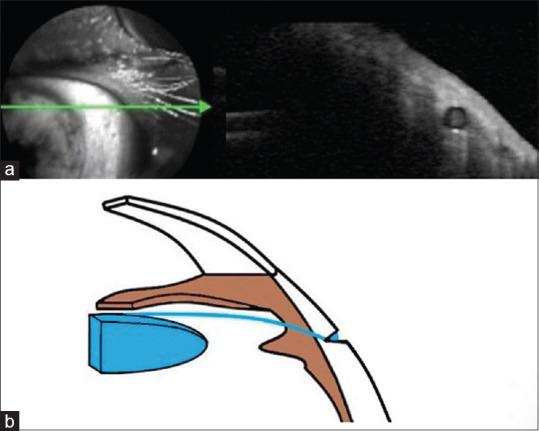 https://cdn.ncbi.nlm.nih.gov/pmc/blobs/6572/11624642/d2168129d5c2/IJO-72-224-g003.jpg