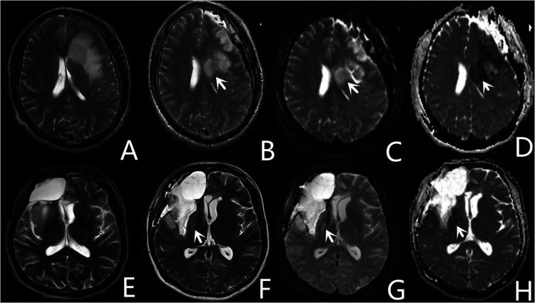 https://cdn.ncbi.nlm.nih.gov/pmc/blobs/657c/9614341/c16167866abf/fsurg-09-956872-g004.jpg