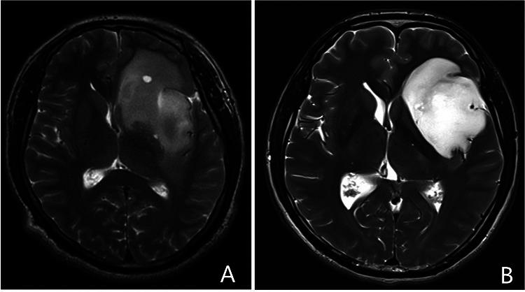 https://cdn.ncbi.nlm.nih.gov/pmc/blobs/657c/9614341/d46f0bd4e5f4/fsurg-09-956872-g003.jpg