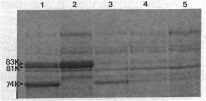 https://cdn.ncbi.nlm.nih.gov/pmc/blobs/6585/214889/d1cede5887b8/jbacter00224-0447-a.jpg