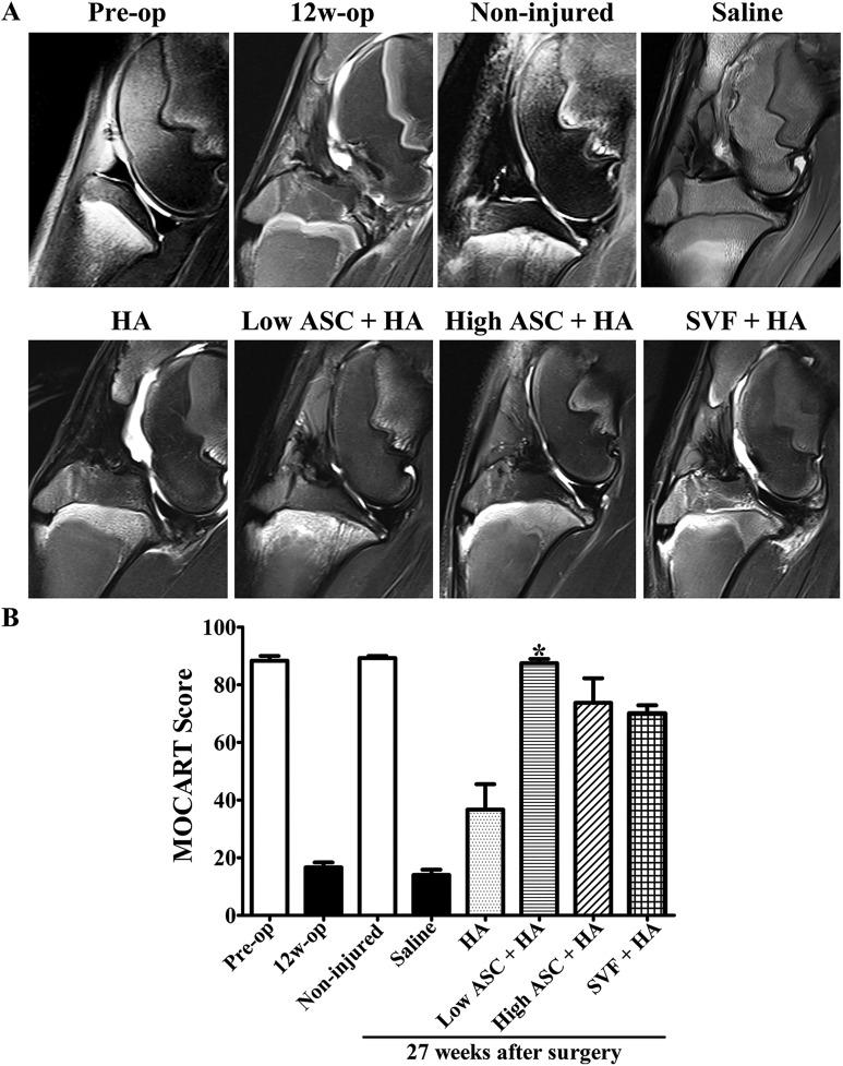 https://cdn.ncbi.nlm.nih.gov/pmc/blobs/658a/6158543/2c5a4e57f849/10.1177_0963689718773333-fig2.jpg