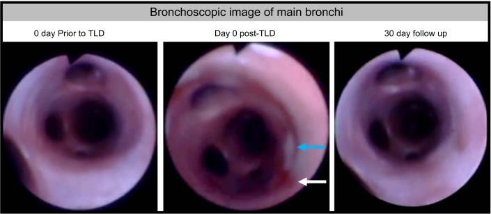 https://cdn.ncbi.nlm.nih.gov/pmc/blobs/658d/6383645/6c0d2cd53ccd/zdg0111828470006.jpg