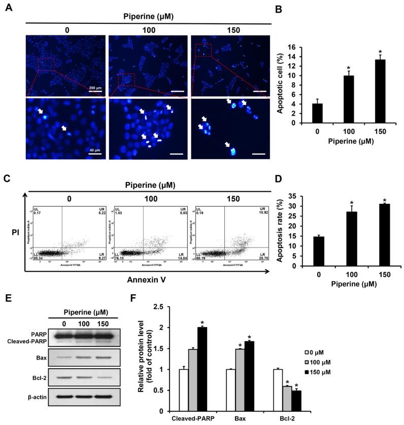 https://cdn.ncbi.nlm.nih.gov/pmc/blobs/658e/10530752/58ad7fcd08c9/ijms-24-13949-g002.jpg