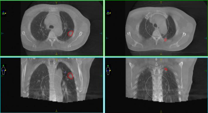 https://cdn.ncbi.nlm.nih.gov/pmc/blobs/6595/11168913/2caaf66642c3/TCA-15-1333-g004.jpg