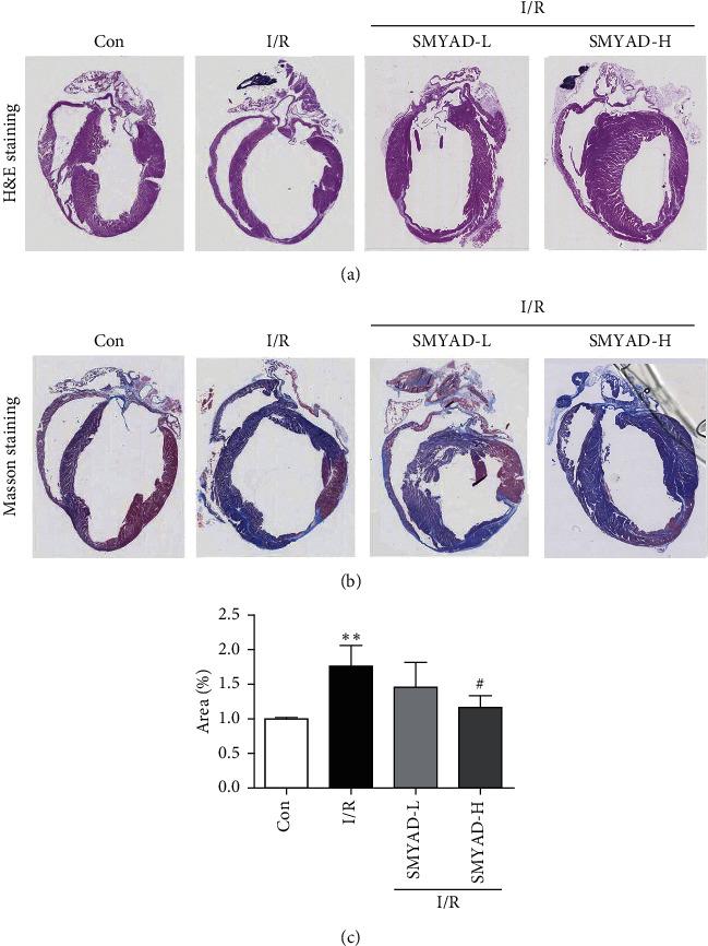 https://cdn.ncbi.nlm.nih.gov/pmc/blobs/6598/8337144/aae2e150f533/ECAM2021-8968464.003.jpg