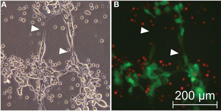 https://cdn.ncbi.nlm.nih.gov/pmc/blobs/659b/4215694/09cc4e8479e1/fphys-05-00400-g0007.jpg