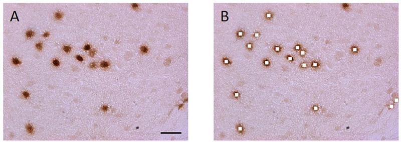 https://cdn.ncbi.nlm.nih.gov/pmc/blobs/659c/8119777/12451f4eb78b/fnana-15-563854-g002.jpg