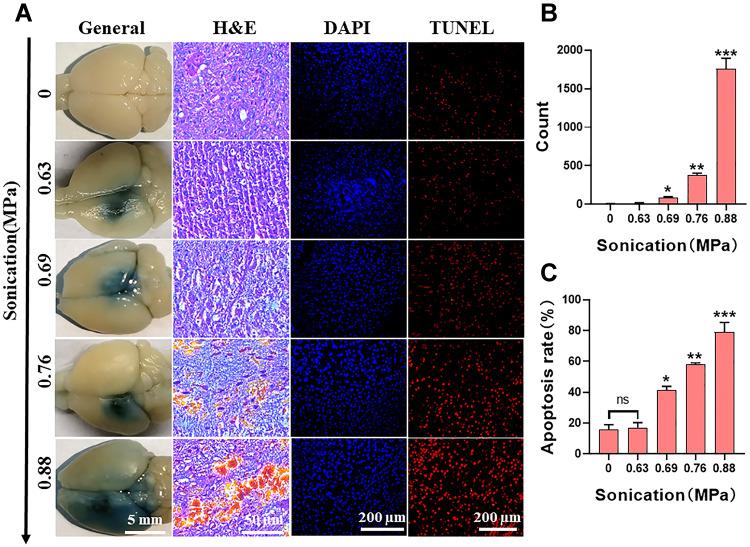 https://cdn.ncbi.nlm.nih.gov/pmc/blobs/659e/9078874/50e158e3d221/IJN-17-2001-g0009.jpg