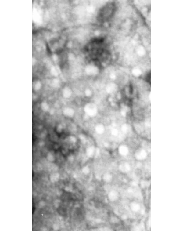 https://cdn.ncbi.nlm.nih.gov/pmc/blobs/65a4/2246209/d85e05065873/cc6176-1.jpg