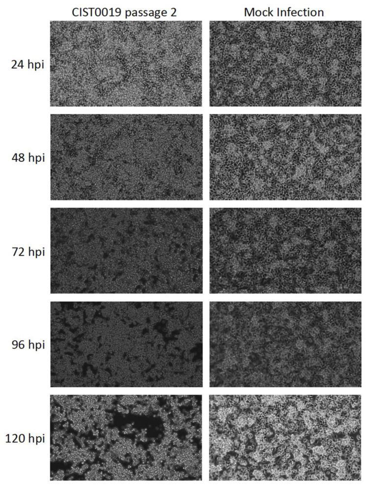 https://cdn.ncbi.nlm.nih.gov/pmc/blobs/65a7/10143313/917bc1c1d0d1/viruses-15-00953-g001.jpg