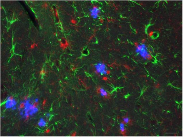 https://cdn.ncbi.nlm.nih.gov/pmc/blobs/65a9/9009508/73a3ca4deae4/fnins-16-807473-g005.jpg