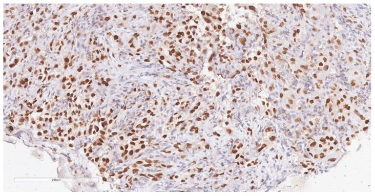 https://cdn.ncbi.nlm.nih.gov/pmc/blobs/65b3/11083520/0571211affe4/diagnostics-14-00904-g005.jpg