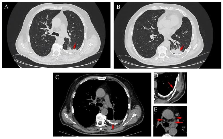 https://cdn.ncbi.nlm.nih.gov/pmc/blobs/65b3/11083520/734b6f9f9384/diagnostics-14-00904-g002.jpg