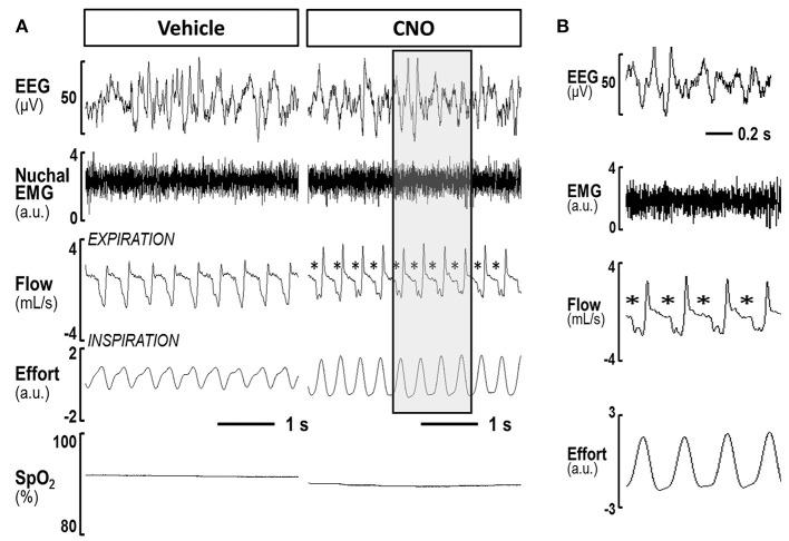 https://cdn.ncbi.nlm.nih.gov/pmc/blobs/65b4/6246694/58529766718b/fneur-09-00962-g0005.jpg