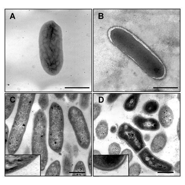 https://cdn.ncbi.nlm.nih.gov/pmc/blobs/65ba/1186022/dee9205f243a/1471-2180-5-41-6.jpg