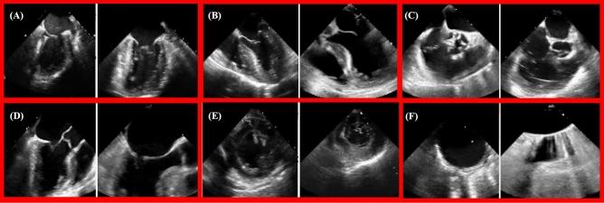 https://cdn.ncbi.nlm.nih.gov/pmc/blobs/65bc/10761863/1e97308d9fcc/41598_2023_50735_Fig5_HTML.jpg
