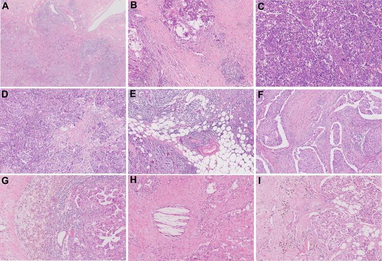 https://cdn.ncbi.nlm.nih.gov/pmc/blobs/65ca/12141058/24013dda619f/gr1.jpg