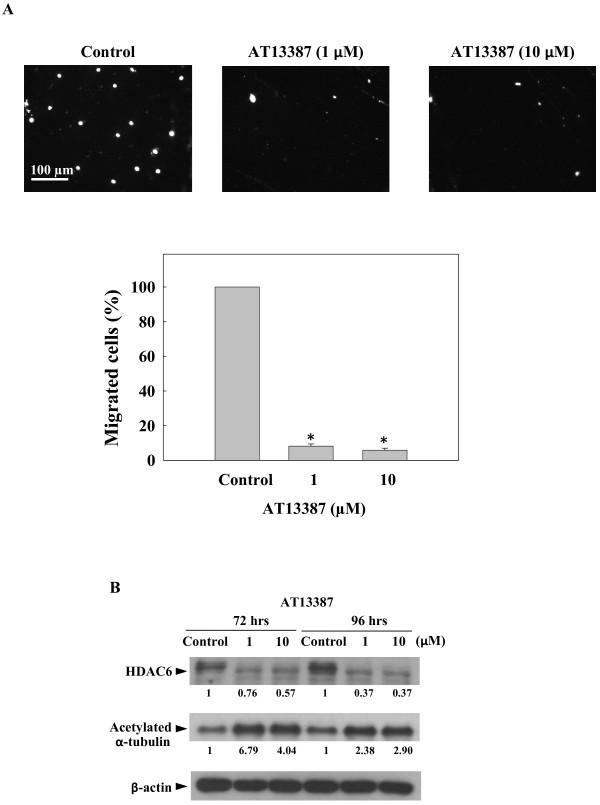https://cdn.ncbi.nlm.nih.gov/pmc/blobs/65ce/3834878/14cde572617f/1476-4598-12-128-4.jpg