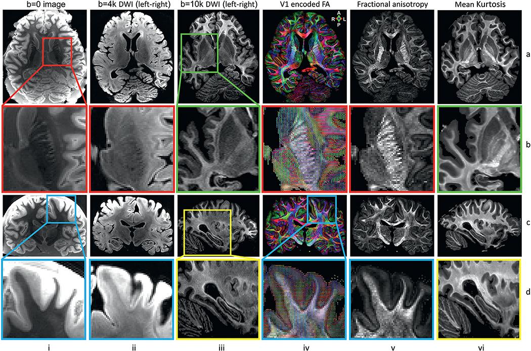 https://cdn.ncbi.nlm.nih.gov/pmc/blobs/65d2/8439104/428bcf85fa09/nihms-1730649-f0009.jpg