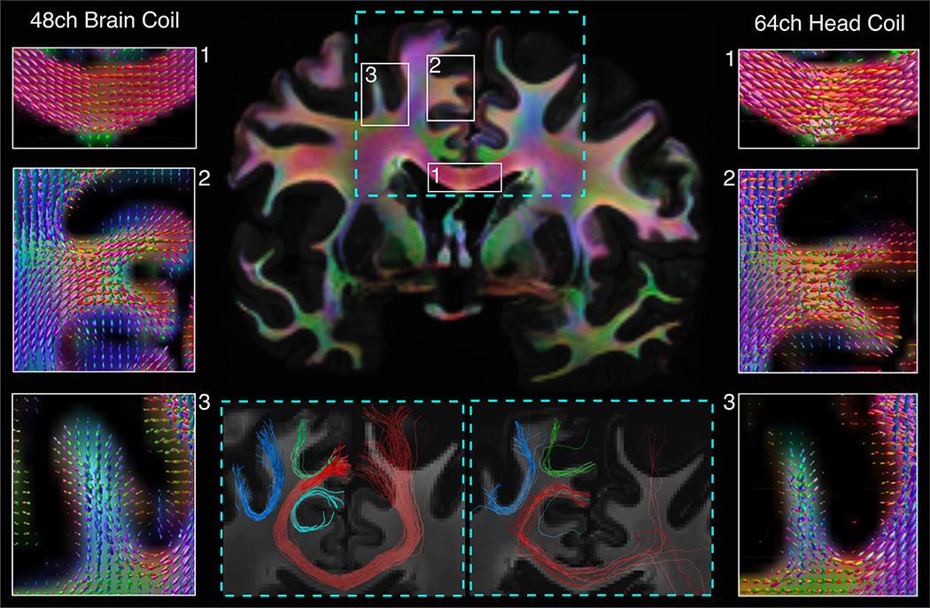 https://cdn.ncbi.nlm.nih.gov/pmc/blobs/65d2/8439104/4761d95317b8/nihms-1730649-f0010.jpg