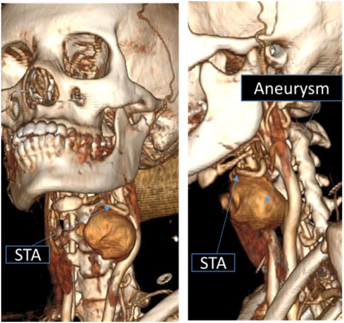 https://cdn.ncbi.nlm.nih.gov/pmc/blobs/65d8/10685046/a927a5ae8abe/gr1.jpg