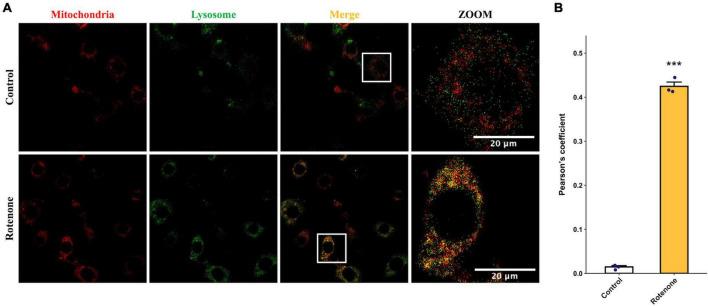 https://cdn.ncbi.nlm.nih.gov/pmc/blobs/65d8/11066238/b4608dcad86f/fnmol-17-1359294-g004.jpg