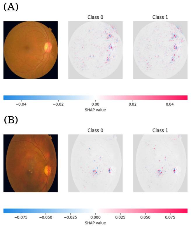 https://cdn.ncbi.nlm.nih.gov/pmc/blobs/65e0/12346750/e96c3bb00d3f/diagnostics-15-01966-g008.jpg