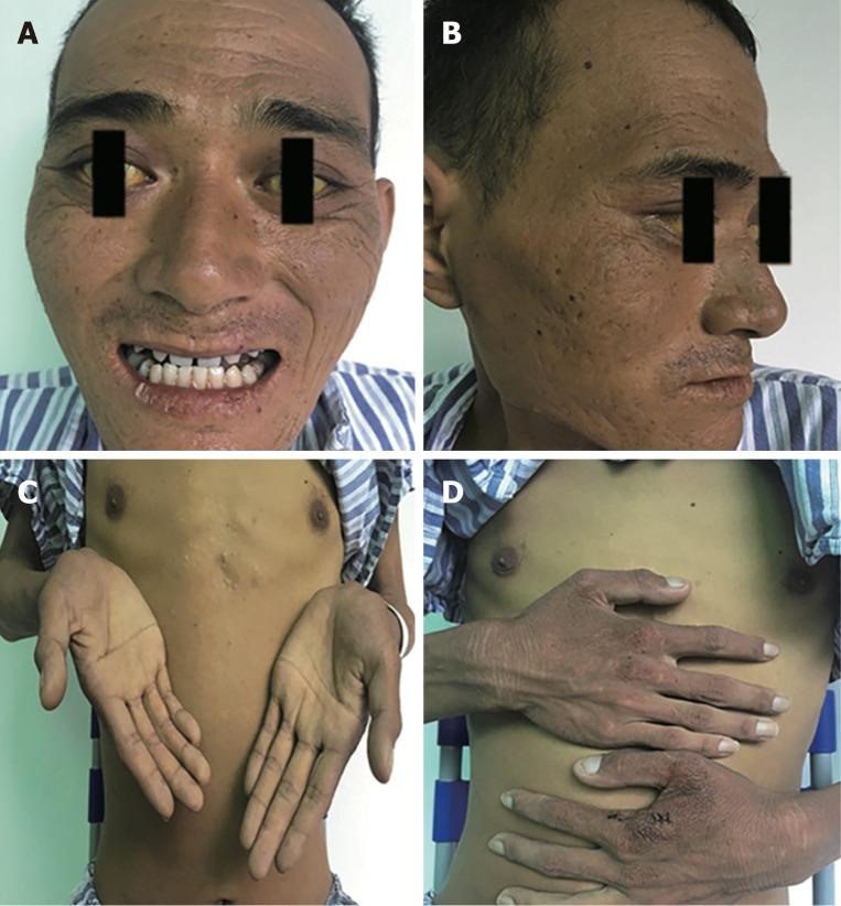 https://cdn.ncbi.nlm.nih.gov/pmc/blobs/65e2/6385011/256afb062328/WJG-25-880-g001.jpg