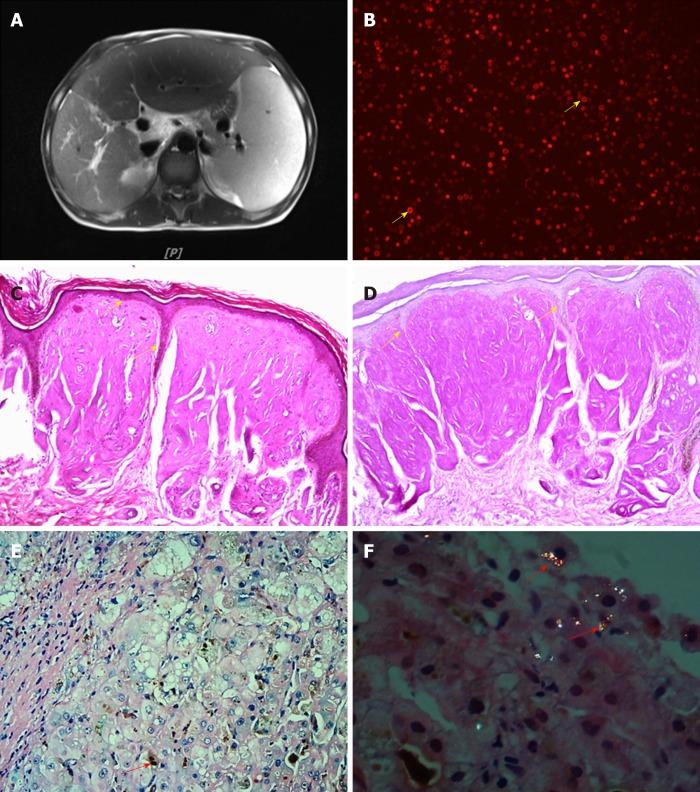 https://cdn.ncbi.nlm.nih.gov/pmc/blobs/65e2/6385011/e7d6e878754f/WJG-25-880-g002.jpg