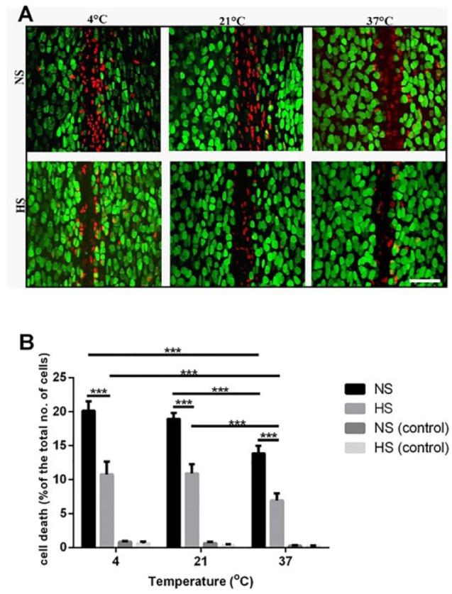 https://cdn.ncbi.nlm.nih.gov/pmc/blobs/65e3/6042036/9cb2a8593037/10.1177_1947603516688511-fig3.jpg