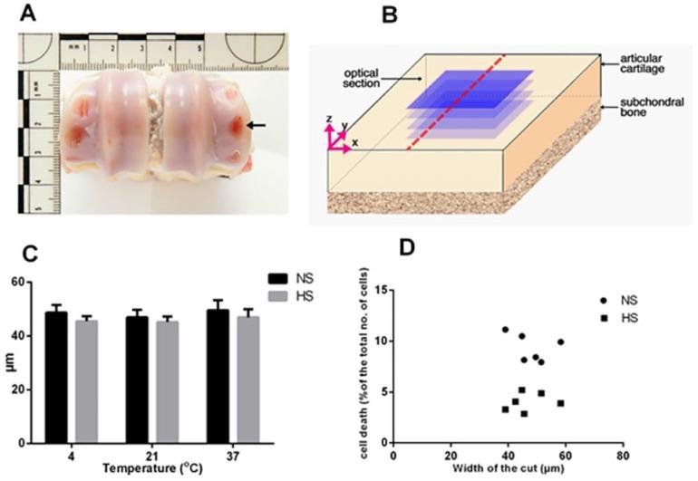 https://cdn.ncbi.nlm.nih.gov/pmc/blobs/65e3/6042036/bdc125232564/10.1177_1947603516688511-fig1.jpg