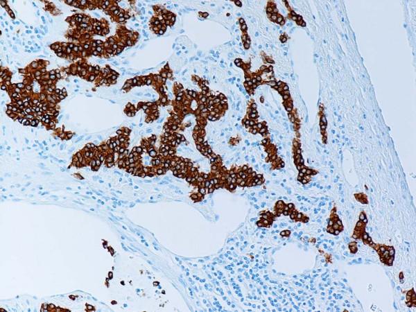 https://cdn.ncbi.nlm.nih.gov/pmc/blobs/65e7/2174438/5747aaf2b8ea/1746-1596-2-43-8.jpg