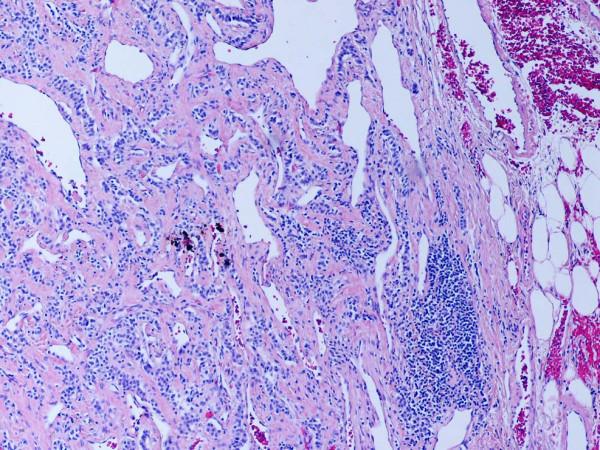 https://cdn.ncbi.nlm.nih.gov/pmc/blobs/65e7/2174438/fced6a86c240/1746-1596-2-43-7.jpg