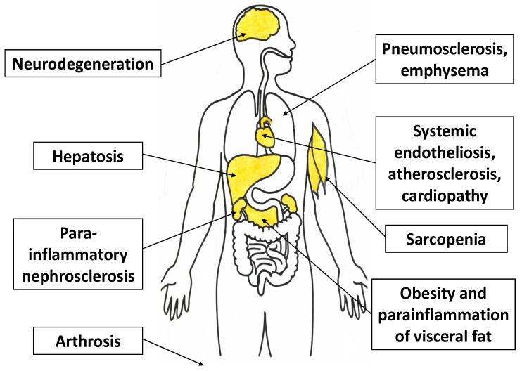 https://cdn.ncbi.nlm.nih.gov/pmc/blobs/65e7/9100490/58a28c42a596/ijms-23-04596-g007.jpg