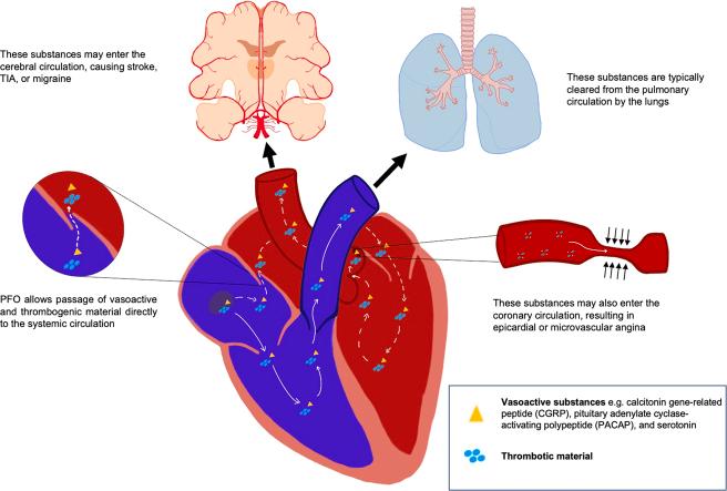https://cdn.ncbi.nlm.nih.gov/pmc/blobs/65fa/10774900/cb8ae67a2fb9/ga1.jpg