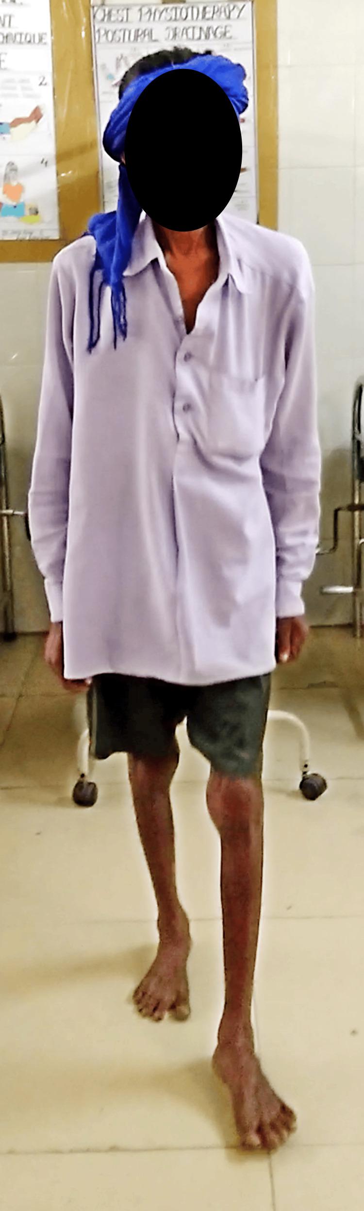 https://cdn.ncbi.nlm.nih.gov/pmc/blobs/65fa/10993079/41fa722a3432/cureus-0016-00000055537-i02.jpg
