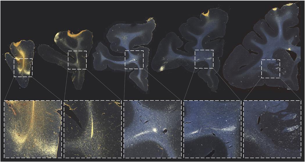 https://cdn.ncbi.nlm.nih.gov/pmc/blobs/6600/8475636/b20e6594c369/nihms-1732192-f0005.jpg